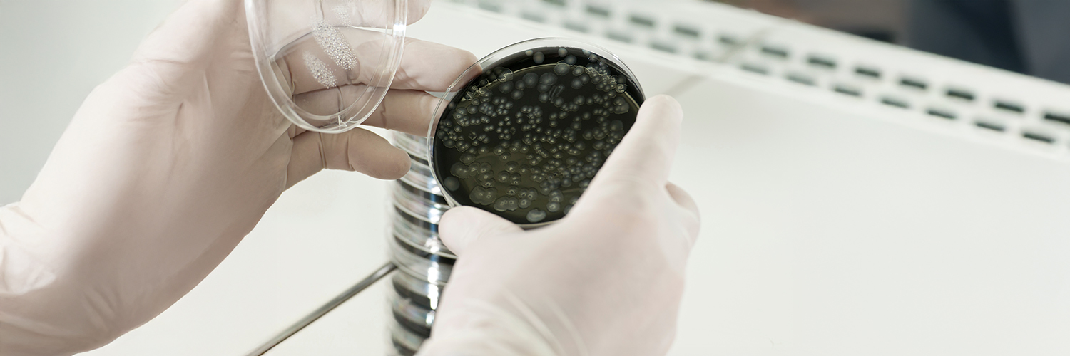 © Adobe Stock - Diego Calvi Culture bactérienne