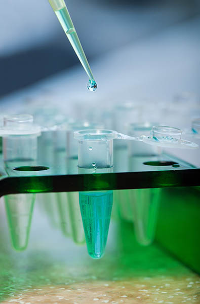 © laboratoire analyse rsde